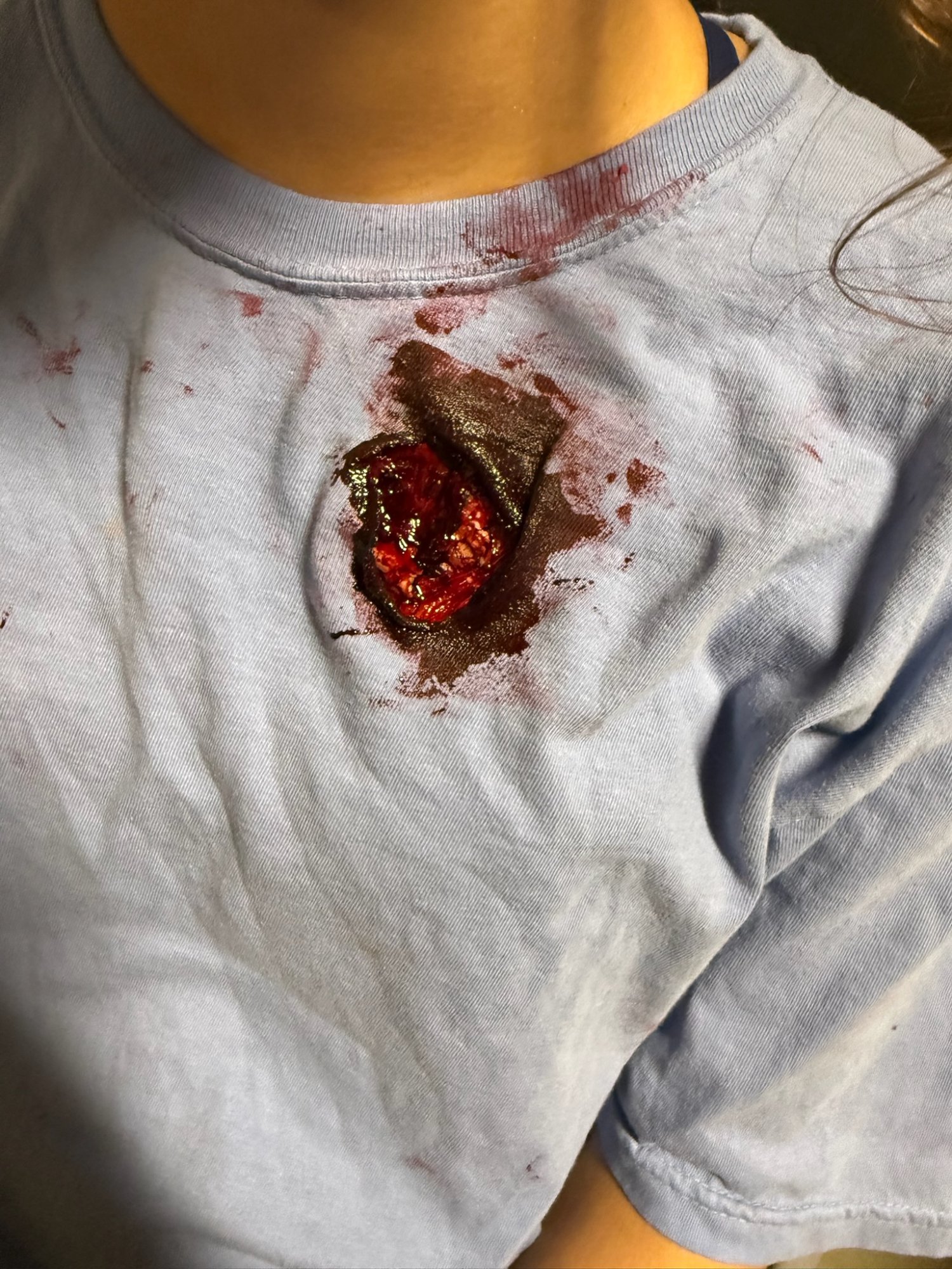Simulated chest gunshot wound