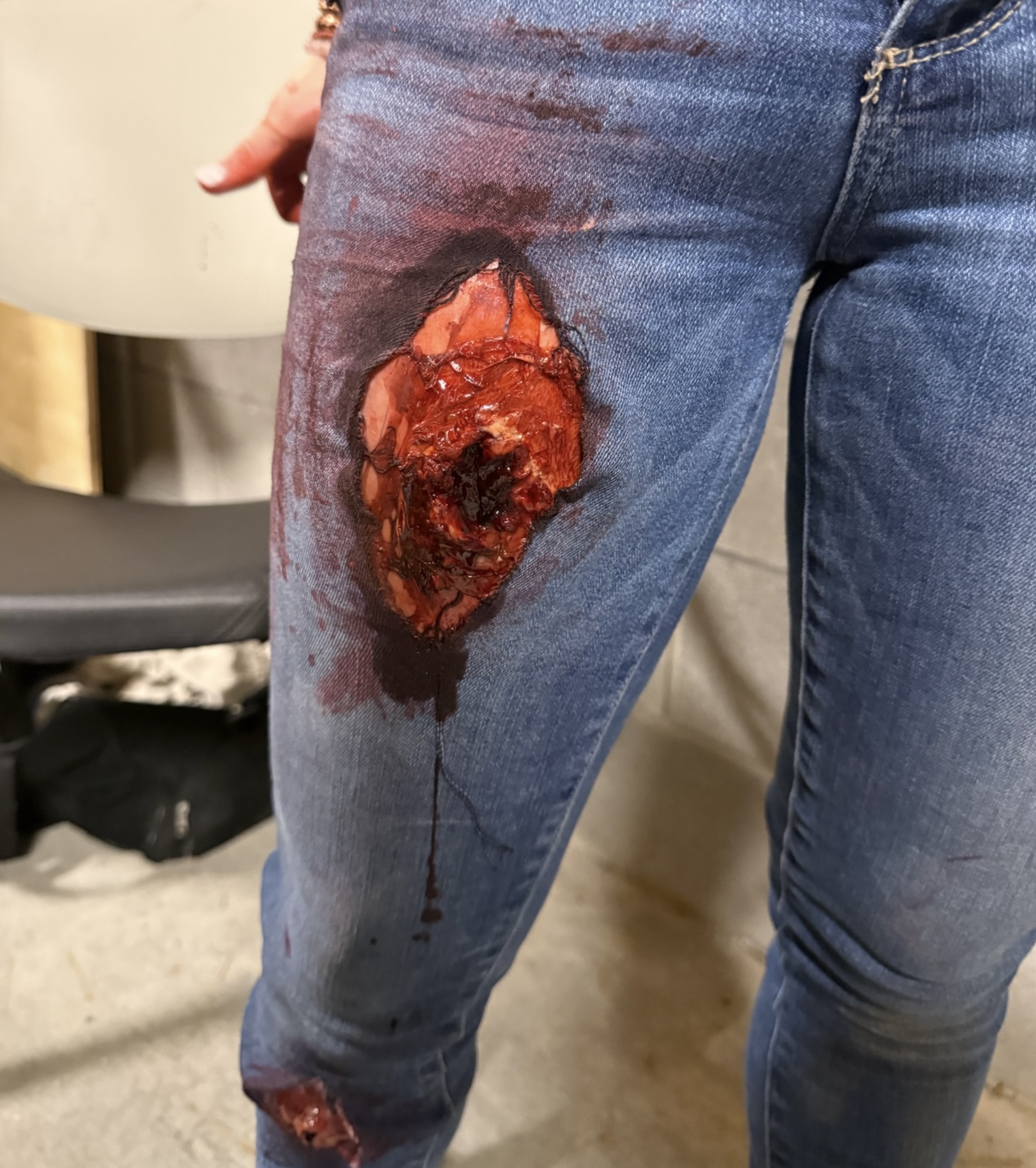 Simulated thigh wound with exposed tissue
